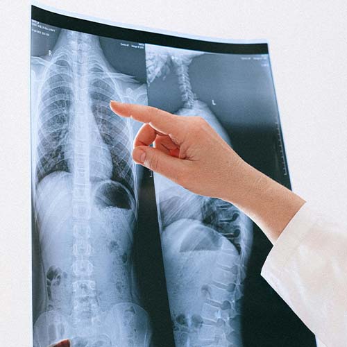 Hand pointing at a x-ray